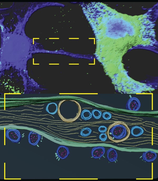 SARS-CoV-2 Uses Nanotubes to Sneak into Neurons.